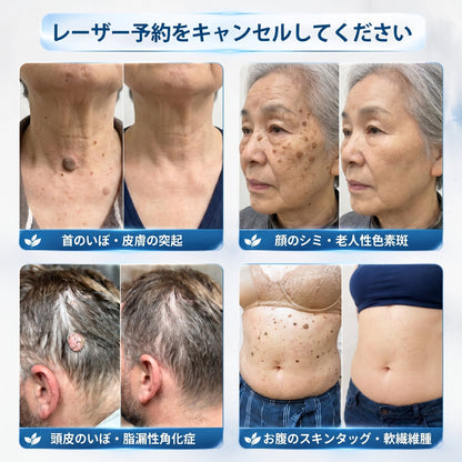 日本𝐏i𝐜𝐝o® 7日間 シミ取り 傷跡ケア ペン(痛みゼロ、傷ゼロのローラーボール)💪