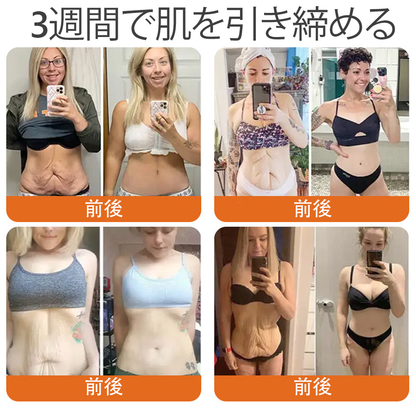 日本製・発送 ✨𝑫𝒐𝒓𝒎𝒐𝒓𝒏𝒂® 蜂毒総合クリーム🔥最終日 80%𝑶𝑭𝑭💎💎