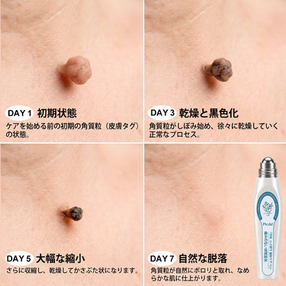 日本𝐏i𝐜𝐝o® 7日間 シミ取り 傷跡ケア ペン(痛みゼロ、傷ゼロのローラーボール)💪