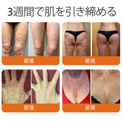 日本製・発送 ✨𝑫𝒐𝒓𝒎𝒐𝒓𝒏𝒂® 蜂毒総合クリーム🔥最終日 80%𝑶𝑭𝑭💎💎