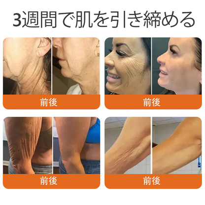 日本製・発送 ✨𝑫𝒐𝒓𝒎𝒐𝒓𝒏𝒂® 蜂毒総合クリーム🔥最終日 80%𝑶𝑭𝑭💎💎