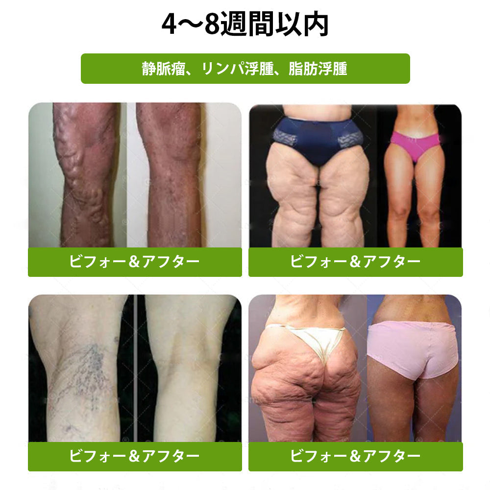 🌝公式ストア | 𝑳𝒖𝒙𝒂𝒓𝒊𝒔𝒆® モリンガ＆ベルベリン 10-IN-1 高機能ナノマイクロニードルパッチ（1日1回、7日で変化を実感）✅肥満・糖尿病・睡眠時無呼吸症候群・関節の悩み向け