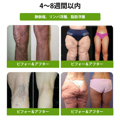 🌝公式ストア | 𝑳𝒖𝒙𝒂𝒓𝒊𝒔𝒆® モリンガ＆ベルベリン 10-IN-1 高機能ナノマイクロニードルパッチ（1日1回、7日で変化を実感）✅肥満・糖尿病・睡眠時無呼吸症候群・関節の悩み向け