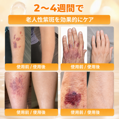 🔥🔥𝐃𝐨𝐫𝗺𝐨𝐫𝗻𝗮®公式ストア • 日本製 👑𝗗𝐨𝐫𝗺𝐨𝐫𝗻𝗮® 蜂毒配合オールインワンクリーム 🌟本日最終日 – 𝟖𝟎％OFF