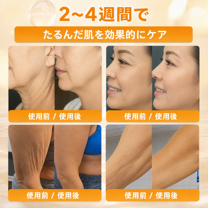 🔥🔥𝐃𝐨𝐫𝗺𝐨𝐫𝗻𝗮®公式ストア • 日本製 👑𝗗𝐨𝐫𝗺𝐨𝐫𝗻𝗮® 蜂毒配合オールインワンクリーム 🌟本日最終日 – 𝟖𝟎％OFF