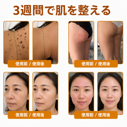 🔥🔥𝐃𝐨𝐫𝗺𝐨𝐫𝗻𝗮®公式ストア • 日本製 👑𝗗𝐨𝐫𝗺𝐨𝐫𝗻𝗮® 蜂毒配合オールインワンクリーム 🌟本日最終日 – 𝟖𝟎％OFF