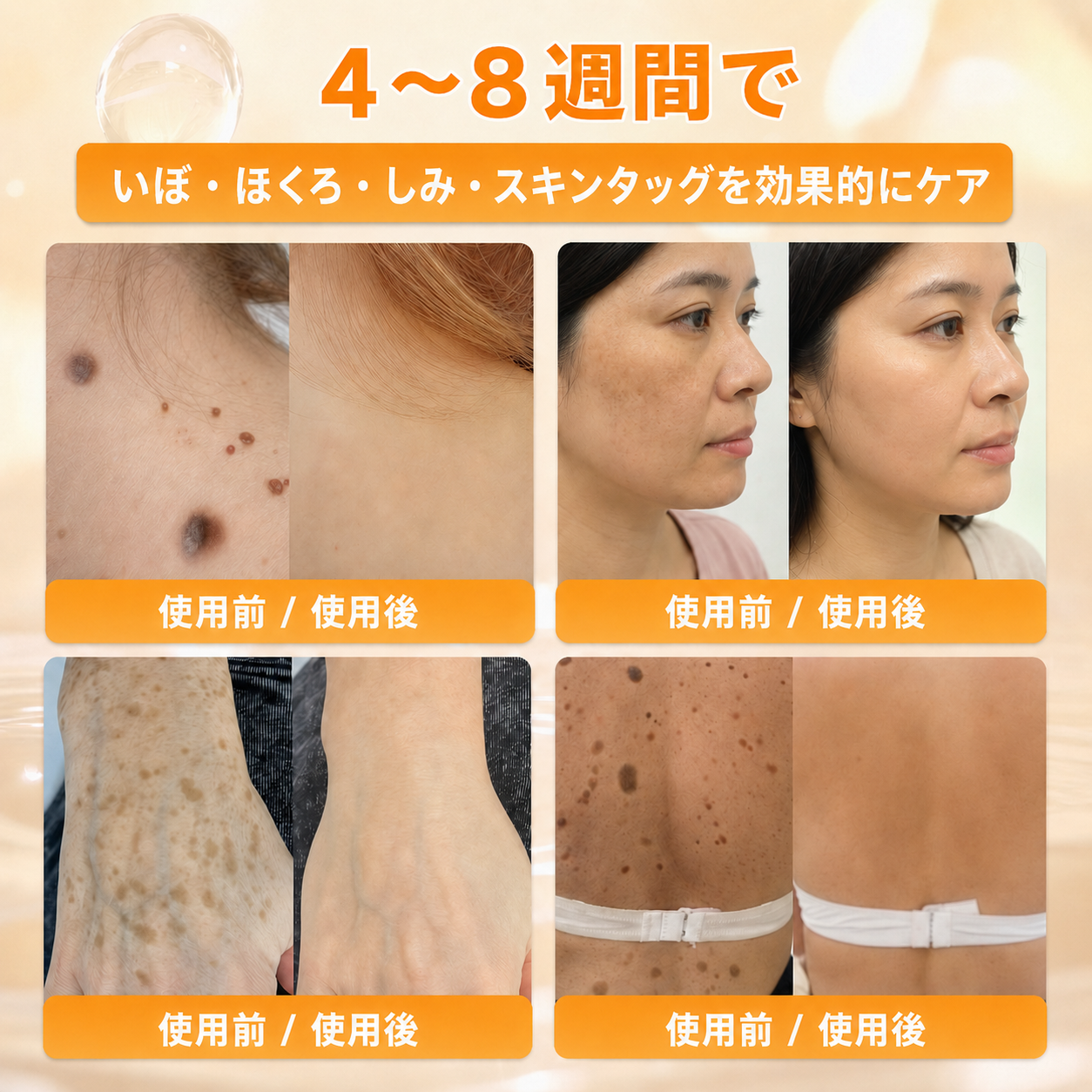 🔥𝗗𝗼𝗿𝗺𝗼𝗿𝗻𝗮® 公式ストア｜日本製 🇯🇵 🎐蜂毒オールインワンクリーム 🌟本日まで！最大𝟴𝟬％ 𝗢𝗙𝗙
