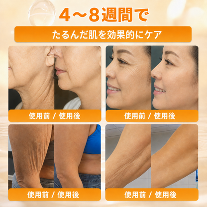 🔥𝗗𝗼𝗿𝗺𝗼𝗿𝗻𝗮® 公式ストア｜日本製 🇯🇵 🪴蜂毒オールインワンクリーム 🌟本日まで！最大𝟴𝟬％ 𝗢𝗙𝗙