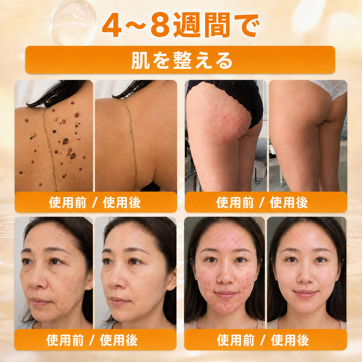 🔥𝗗𝗼𝗿𝗺𝗼𝗿𝗻𝗮® 公式ストア｜日本製 🇯🇵 🎐蜂毒オールインワンクリーム 🌟本日まで！最大𝟴𝟬％ 𝗢𝗙𝗙