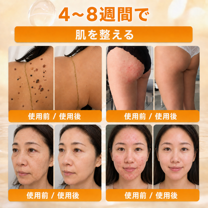 🔥𝗗𝗼𝗿𝗺𝗼𝗿𝗻𝗮® 公式ストア｜日本製 🇯🇵 🎐蜂毒オールインワンクリーム 🌟本日まで！最大𝟴𝟬％ 𝗢𝗙𝗙