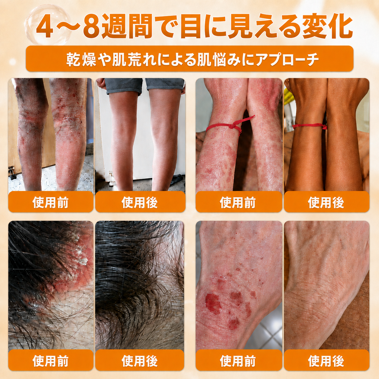 🔥𝗗𝗼𝗿𝗺𝗼𝗿𝗻𝗮® 公式ストア｜日本製 🇯🇵 🎐蜂毒オールインワンクリーム 🌟本日まで！最大𝟴𝟬％ 𝗢𝗙𝗙