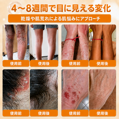 🔥𝗗𝗼𝗿𝗺𝗼𝗿𝗻𝗮® 公式ストア｜日本製 🇯🇵 🎐蜂毒オールインワンクリーム 🌟本日まで！最大𝟴𝟬％ 𝗢𝗙𝗙